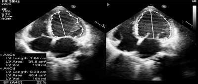 Photograph showing carpal spasm on compression of forearm. | Download Scientific Diagram