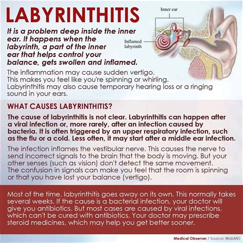 labyrinthitis | Chronic migraines, Inner ear disorders, Vertigo