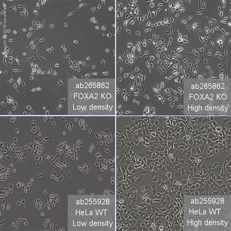 Hela Cell Culture Protocol