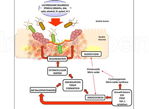 Peptic Ulcer Pathophysiology