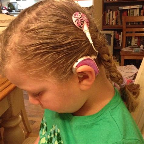 Advanced Bionics Cochlear Implant Naida Decorated with sparkle tape ...