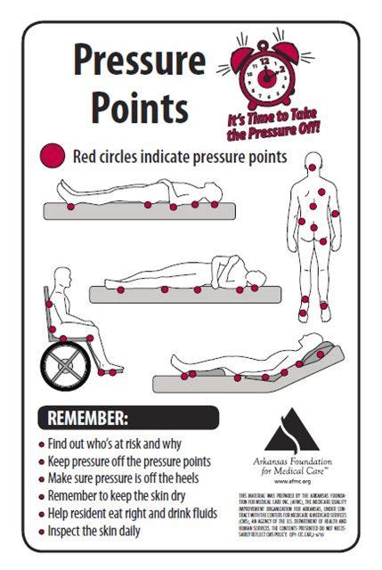 29 best Pressure Ulcer Information images on Pinterest | Nurses ...