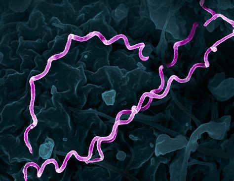 Treponema pallidum Bacteria (Syphilis) | Colorized electron … | Flickr