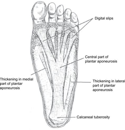 Anatomy of the plantar fascia. Notes: Adapted from Gramatikoff. 42 | Download Scientific Diagram