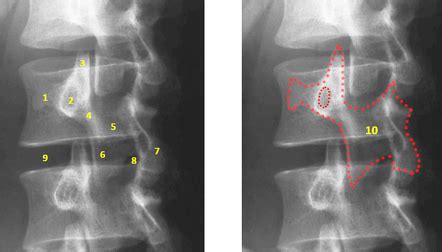 Lumbar spine series | Radiology Reference Article | Radiopaedia.org