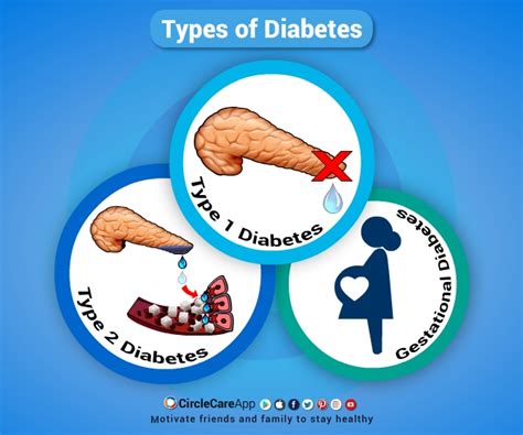 How Much Types Of Diabetes Are There - DiabetesWalls