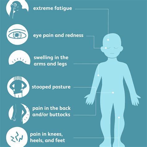 Symptoms of ankylosis spondylitis