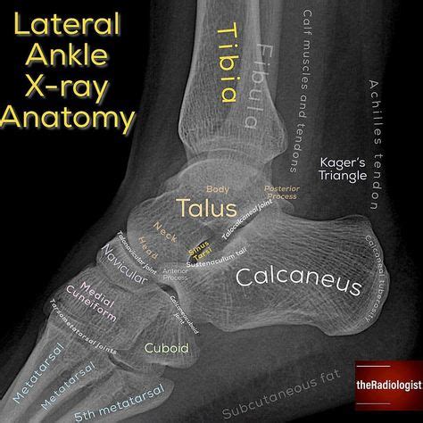 275 mejores imágenes de RADIOLOGY IMAGING en 2020 | Radiología, Imagenologia, Anatomía