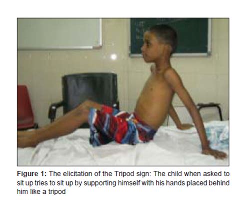 mytest: 17: Tripod Position Child Epiglottitis