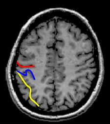 Primer on Cortical Sulci — fMRI 4 Newbies