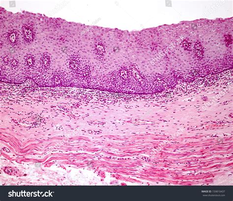 Stratified Squamous Epithelium Non Keratinized Esophagus