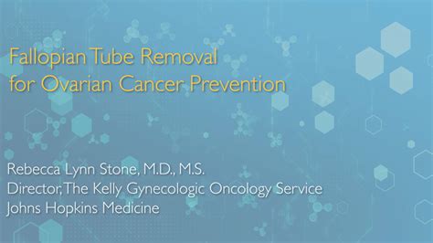 Salpingectomy: Preventing Ovarian Cancer - Johns Hopkins Medicine