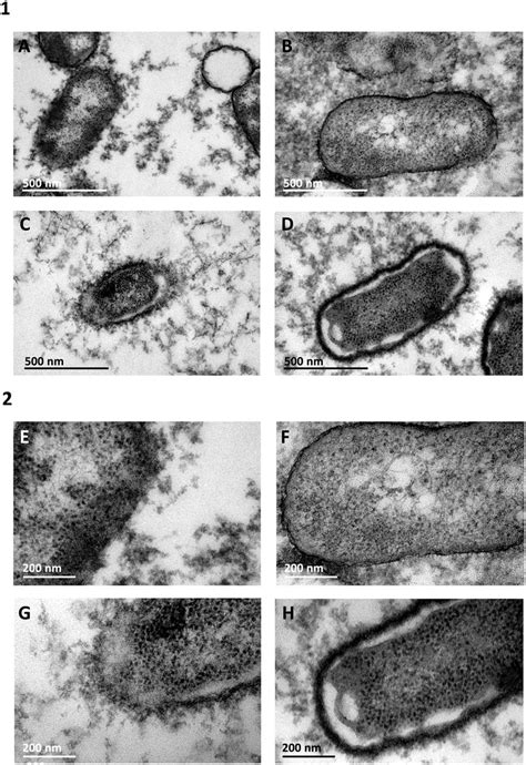 Capsule visualisation by TEM. (A,E) H. influenzae serotype b. (B,F)... | Download Scientific Diagram