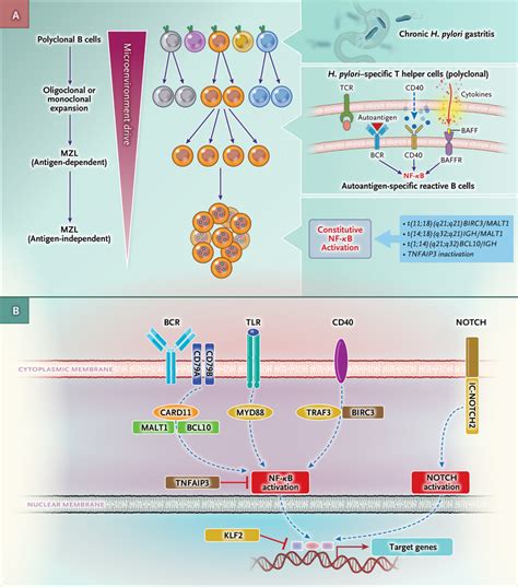 Marginal Zone Lymphoma Diagram