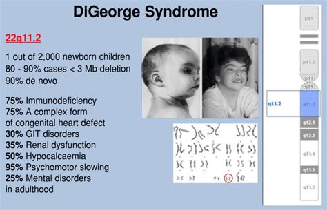 MOLECULAR KARYOTYPE | Asst. Nebojsa Zecevic, MD, PhD, Specialist in ...