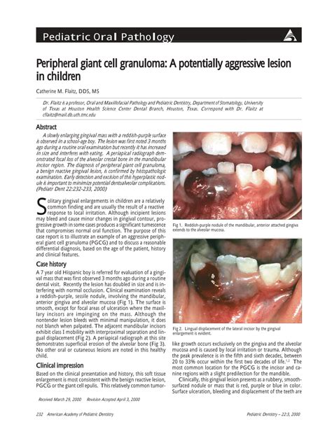 (PDF) Peripheral giant cell granuloma: A potentially aggressive lesion in children