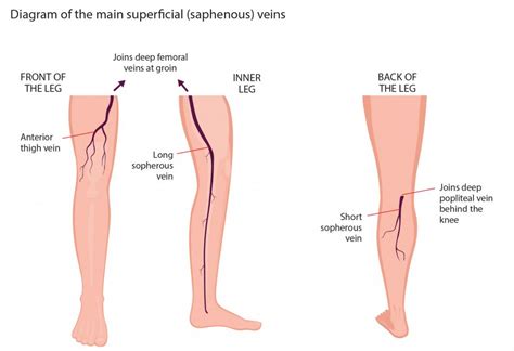 Normal Veins vs Varicose Veins Differences | Southwest Veins