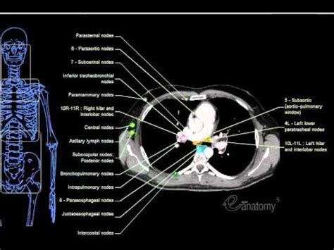 eAnatomy - Mediastinal Lymph Nodes (Hi Qual).mov - YouTube