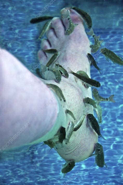 Fish pedicure - Stock Image - C015/3926 - Science Photo Library