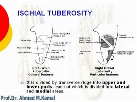 14 L Limb Ischial tuberosity د أحمد كمال cxt - YouTube