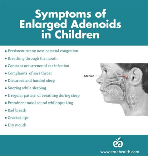 Symptoms of Enlarged Adenoids in children | Bad breath, Remedy for sinus congestion, Sinus ...