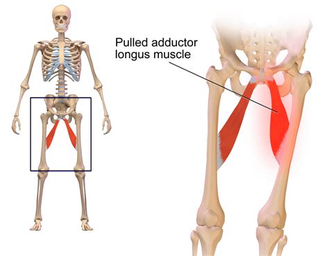 Pérégrination Vide Tombeau pulled groin muscle pain Se ruiner outre le fait que Vaciller