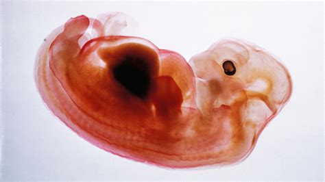 Pig embryos to grow human organs | News | The Sunday Times