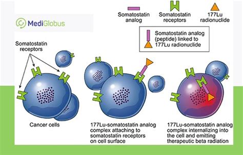 Advanced Cancer Therapy with Lutetium-177 | Medical Tourism with ...