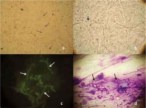 Microscopic examinations of dermatophytic infections. (a) KOH... | Download Scientific Diagram