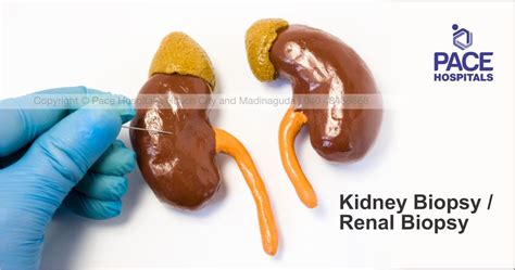 Kidney Biopsy : Indications, Preparation and Procedure