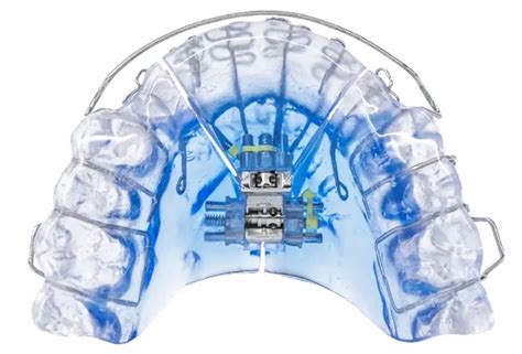 Vivos Therapeutics Receives First Ever FDA 510(k) Clearance for Oral ...