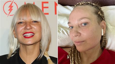 'Chandelier' singer Sia's plastic surgeon reveals why she was honest ...