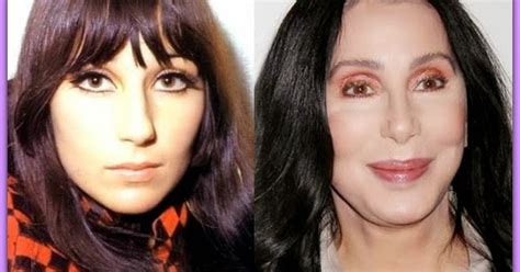 Surgery Plastic Before After: Cher Plastic Surgery – There Are Lots To Tell