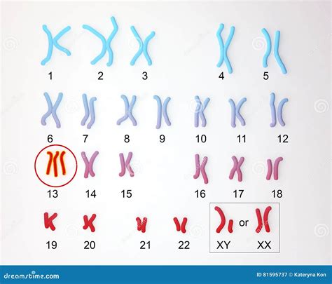 Patau Syndrome Karyotype 58490 | INFOBIT