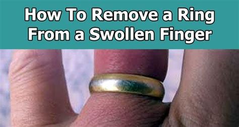 How To Remove A Ring From A Swollen Finger Without Cutting Off The Ring