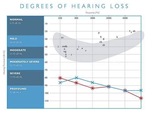 Degrees of Hearing Loss - Hearing Industries Association