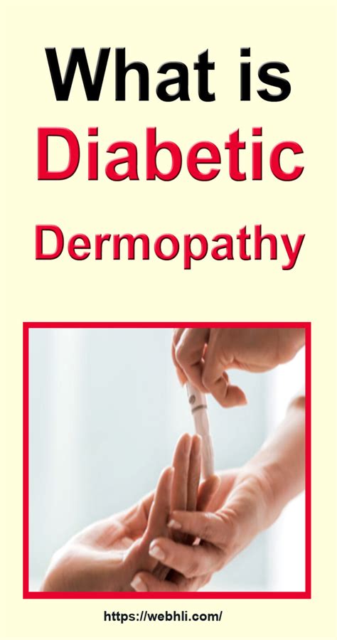 What is Diabetic Dermopathy? | Healthy Lifestyle