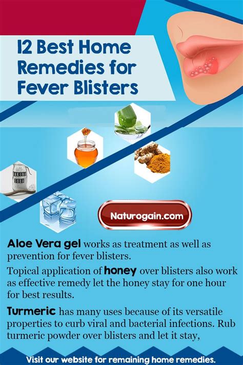 12 Easy and Best Home Remedies for Fever Blisters that Work | Home ...