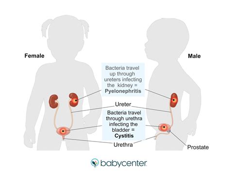 Baby UTI: Symptoms and treatments | BabyCenter