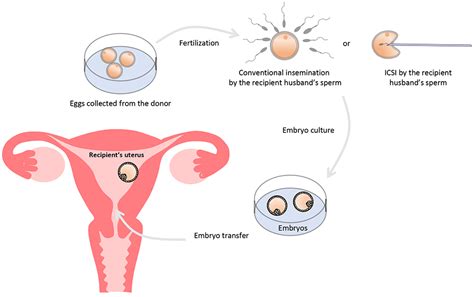 Where To Donate Female Eggs