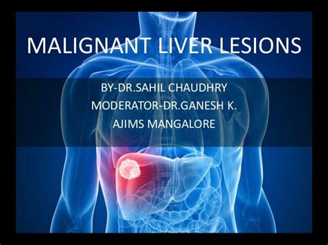 What Causes Hypodense Lesions In The Liver - cloudshareinfo