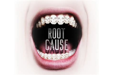 "Root Cause" Netflix Documentary: Let's Review the Science - Today's RDH