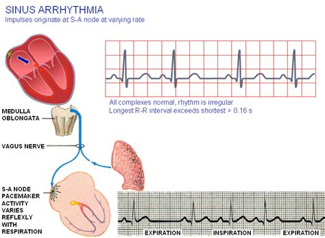 HumBiE: EKG : Sinus Arrhythmia