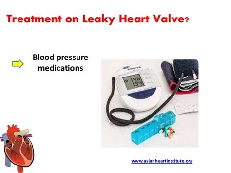 Asian Heart Institute - Leaky heart valve symptoms