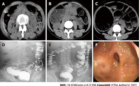 Classic imaging findings of three patients with allied disorders of... | Download Scientific Diagram