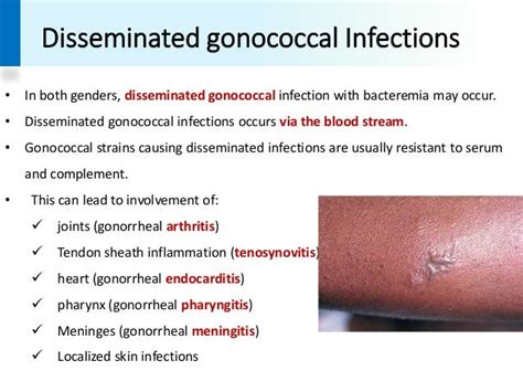 Gonococci