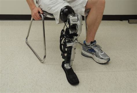 World's First Mind Controlled Prosthetic Leg Unveiled