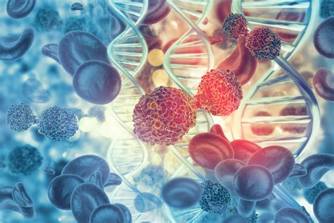 Circulating Tumor DNA Could Improve Diagnosis and Monitoring of MDS