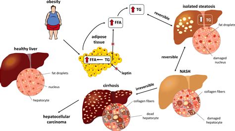 Frontiers Pathophysiology Of Nafld And Nash In Experimental Models | My XXX Hot Girl