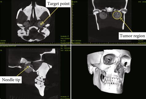 Postoperative CT scan results. | Download Scientific Diagram